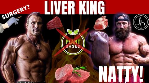 LIVER KING IS NATTY! Here is proof