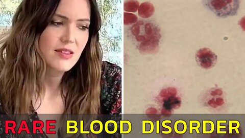 MANDY MOORE WILL HAVE UNMEDICATED BIRTH DUE TO RARE BLOOD DISORDER