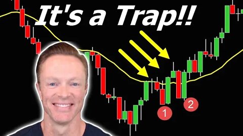 💰💰 TRAP ALERT!! This *BEAR TRAP* Could Be Easiest Money All Week!! 💸