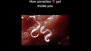 How Parasites get Inside You – Parasites Have Killed More People Than All of the Wars - 12-28-22