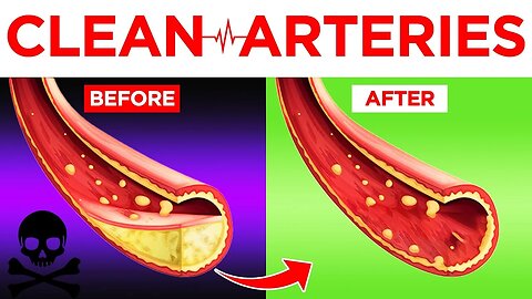 Clear Your Arteries with These Nutritious Foods