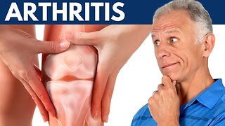What I Wish Everyone Would Know About Arthritis!