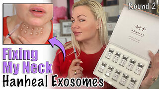 Fixing My Neck with Exosomes, Round 2 from AceCosm.com | Code Jessica10 Saves you Money!