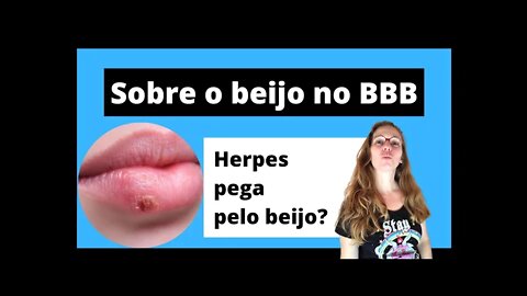 Beijo no BBB: Herpes transmite pelo beijo? - Infectologista responde...