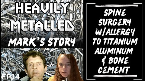 EP14 - Spine Surgery w/Allergy to Titanium, Aluminum & Bone Cement