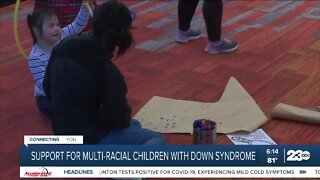 Support for multi-racial children with down syndrome