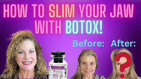 How to Slim Your Jawline With Botox! #beauty #botox #beautytricks