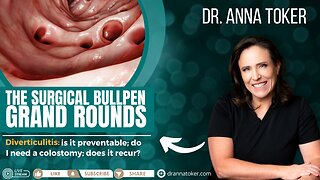 The Surgical Bullpen: Grand Rounds - Diverticulitis