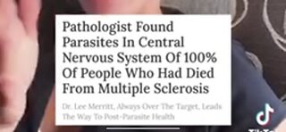 Pathologist Finds Parasites In Central Nervous Systems Of 100% People Who Died Of MS