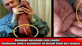 Humanos nascendo com cauda! Fenômeno volta a acontecer no Brasil! Sinal dos tempos