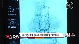 Strokes in younger adults are increasing