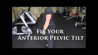 The BEST Way To FIX An Anterior Pelvic Tilt | W/ Lumbar Hyperlordosis