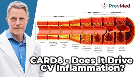 CARD8 - Does It Drive CV Inflammation?
