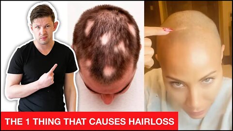 How Jada Pickett Smith Can Stop Hair Loss & Alopecia Naturally!