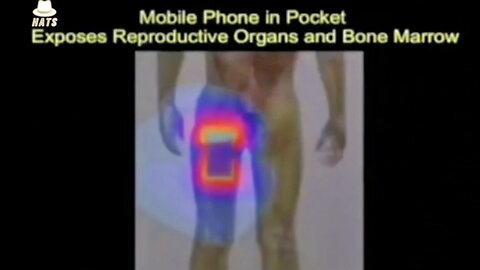 The Shocking Damage Mobile Phone Radiation Does to the Human Body