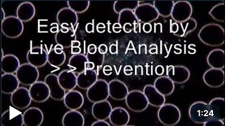 Dark Field Microscopy Live Blood Analysis - Cardio-Vascular Disease