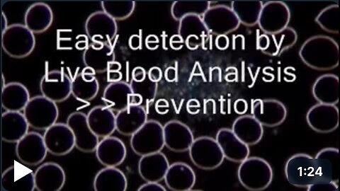 Dark Field Microscopy Live Blood Analysis - Cardio-Vascular Disease