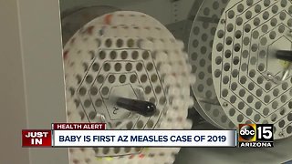 Officials: One-year-old diagnosed with measles in Pima County