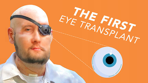 Was The First Eye Transplant SUCCESSFUL?