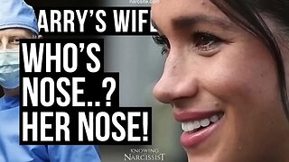 Harry´s Wife Who Nose? Her Nose (Meghan Markle)