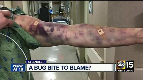 Bug bite still a medical mystery