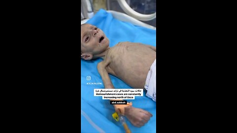 The Genocide Of Children That Is Happening In Front Of Our Eyes
