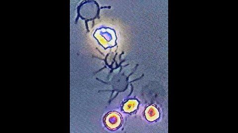 pHase Contrast Optical Microscopy Reveals Spike Protein Being Born OUT of the Red Blood Cell Membranes