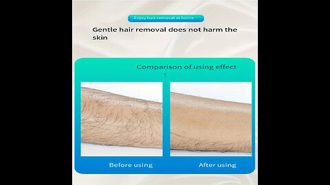 Hair Removal