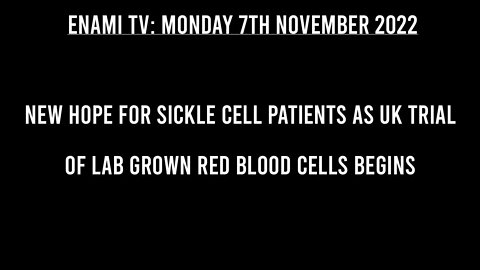 New hope for sickle cell patients as UK trial of lab grown red blood cells begins.