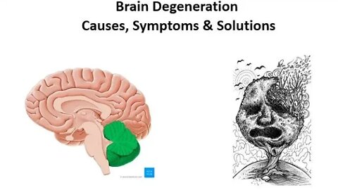 Prevent Brain Degeneration Naturally