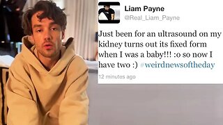 Liam Payne's kidney infection postpones tour