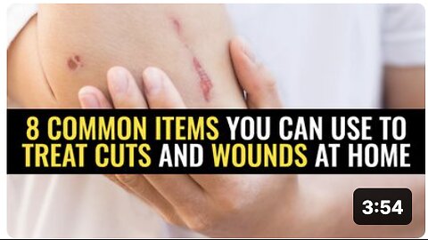 8 Common items you can use to treat cuts and wounds at home