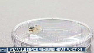 CU researchers create new wearable health device