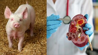 Inside pigs, embryonic humanized kidneys were grown for a period of 28 days by researchers