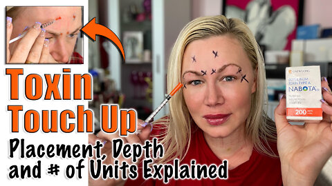 Toxin Touch Up : Placement, Depth and #| of Units Discussed! Code Jessica10 Saves you Money!