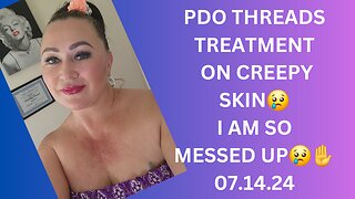 PDO THREADS TREATMENT FOR CREEPY SKIN. I am so messed up this video.07.14.24 #pdothread #creepyskin