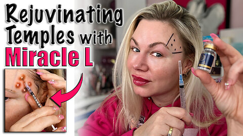 Rejuvinating Temples with Miracle L, its Easy! AceCosm | Code Jessica10 Saves you money