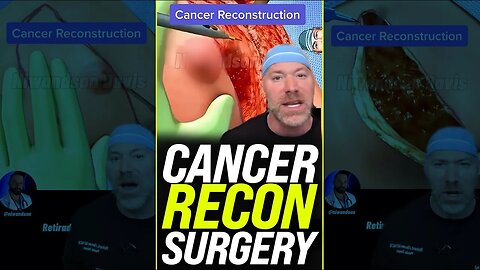 Cancer Reconstruction Surgery 🏥 #surgery