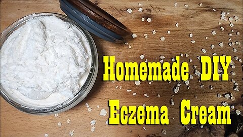 DIY Homemade Eczema Cream for Dry irritated skin ~ Self Reliance Skill