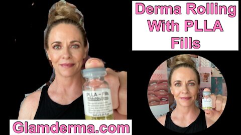 Derma Rolling with PLLA Fills from Glamderma | Plump Up Wrinkles | Use Code LBV10