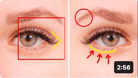 5 Things Your Eyes Are Trying To Tell You About Your Health