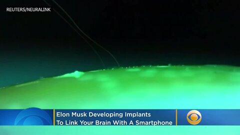 Elon Musk | Elon Musk Is Making Implants To Link YOUR Brain With A Smartphone