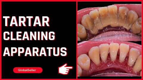 Tartar and Oral Hygiene Plaque Cleaning Apparatus