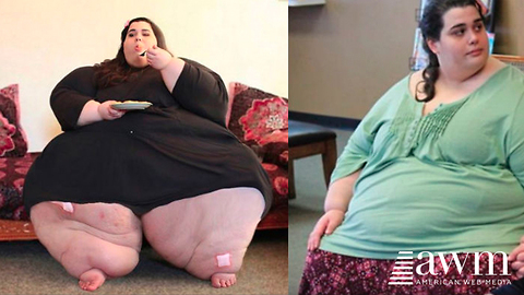 23-Year-Old Weighs 657 Pounds, Changes Three Easy Things; Quickly Drops 400 Pounds