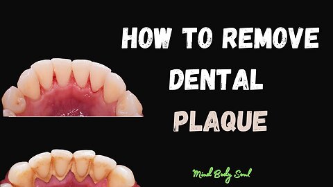 How to Remove Dental Plaque: Oil Pulling Secrets