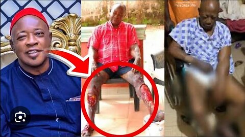 Ailing Actor Amaechi Muonagor Appeals for Financial Support for Kidney Transplant