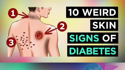 10 Weird SKIN SIGNS of DIABETES
