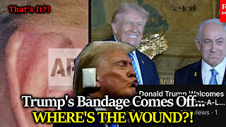 BIG REVEAL: Trump's Bandage Comes Off Showing... Minor Discoloration? Can The Gaslighting Stop Now?