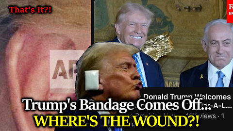 BIG REVEAL: Trump's Bandage Comes Off Showing... Minor Discoloration? Can The Gaslighting Stop Now?