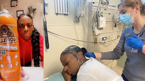 Woman Puts Gorilla Glue In Her Hair And Ends Up In Hospital